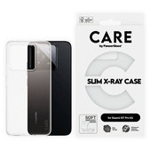 Caz X-Ray pentru Xiaomi 15T Pro 5G, transparent, CARE